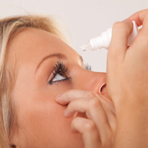 Natural Remedies for Treating Dry Eyes