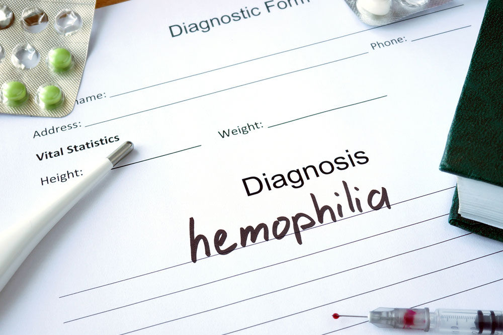 Popular Treatment Options for Hemophilia